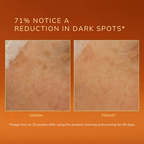 Before and after comparison of dark spots on skin with text about product effectiveness.