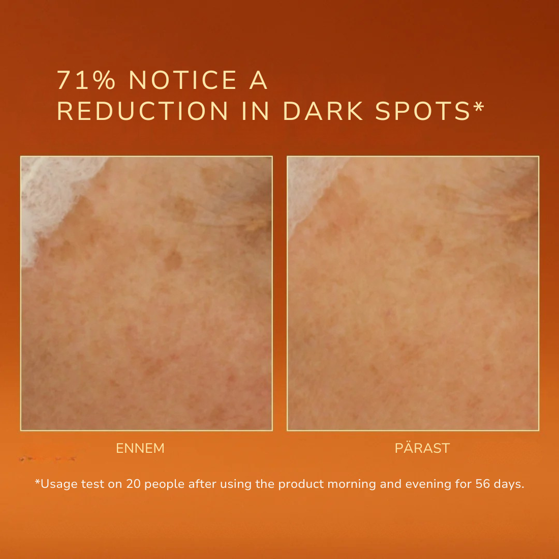 Before and after comparison of dark spots on skin with text about product effectiveness.